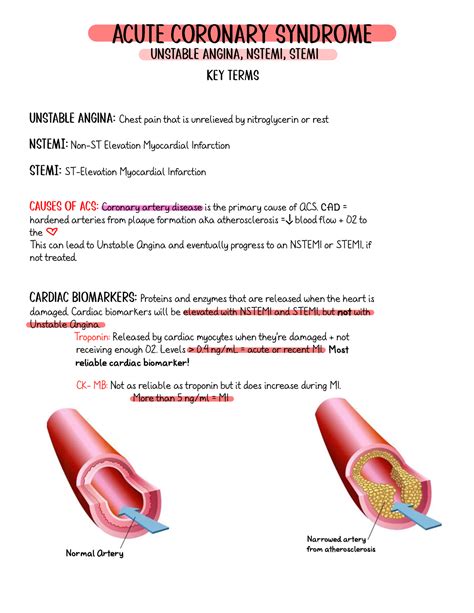 Non Stemi Vs Nstemi