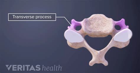 Transverse Process Definition | Back Pain and Neck Pain Medical Glossary