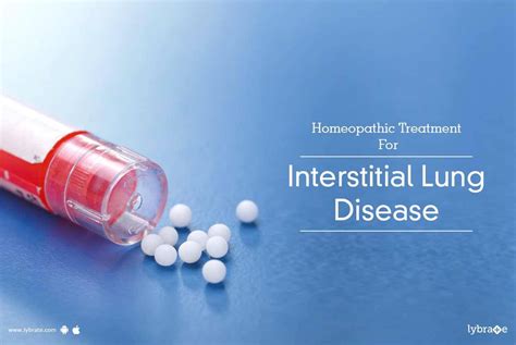 Homeopathic Treatment For Interstitial Lung Disease - By Dr. Prabha Acharya | Lybrate