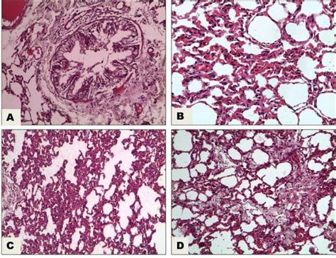 Light Micrograph Of Lung Of Ewe Stained By Hande Showing A Catarrhal Download Scientific