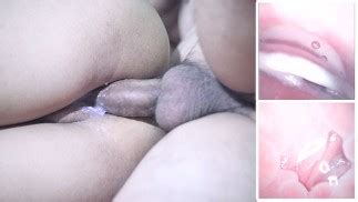 CAMERA INSIDE VAGINA AFTER INTERNAL CREAMPIE สองกลองดอสจในชองคลอด Pornhub