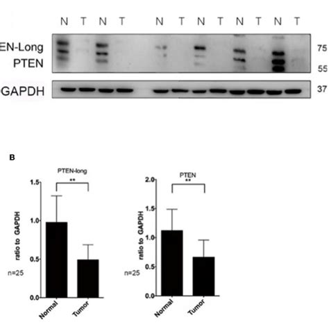 Pten Long Induces Apoptosis Of Hepg Cells A Flow Cytometric