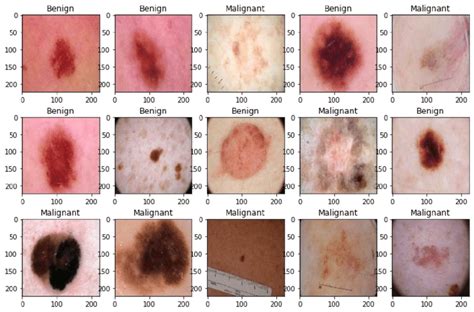 Skin Cancer Dataset And Labels Download Scientific Diagram