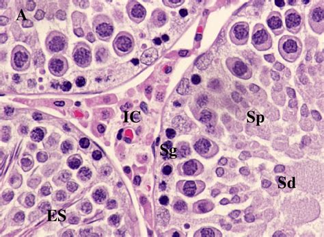 A Section Of The Seminiferous Tubules Of Control Rat Showing Normal Download Scientific