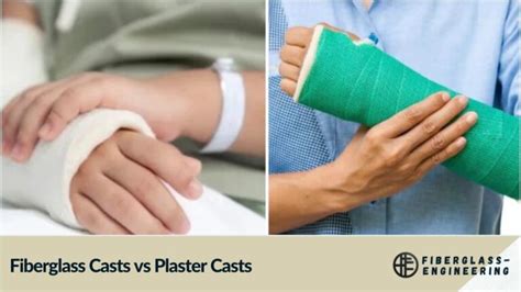 Fiberglass Casts vs Plaster Casts: Which is the Better?