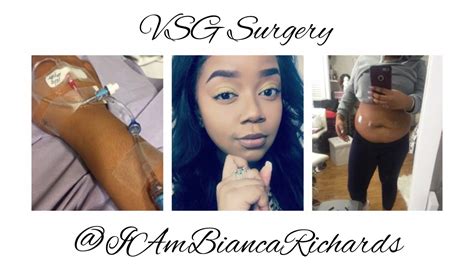 Vsg Surgery Day Weeks Post Op Youtube