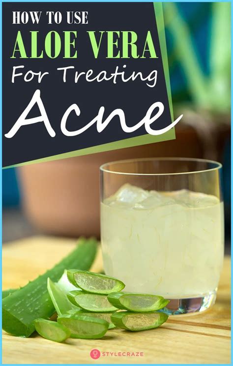 Aloe Vera For Acne: How To Use Aloe Vera For Treating Acne | Home ...