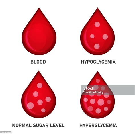 Ilustración De Conjunto De Niveles De Glucosa Y Azúcar En La Sangre Hipoglucemia E Hiperglucemia