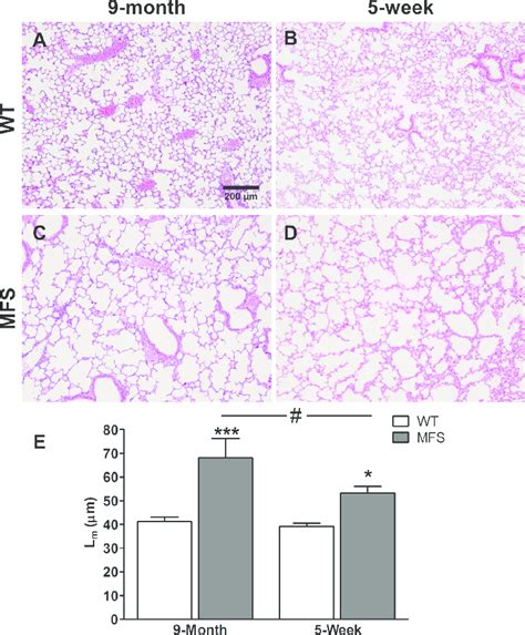 Histological Analysis Of Mouse Lungs Representative H E Stained Images