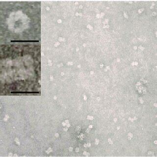 Transmission electron micrograph (negative staining with uranyl ...