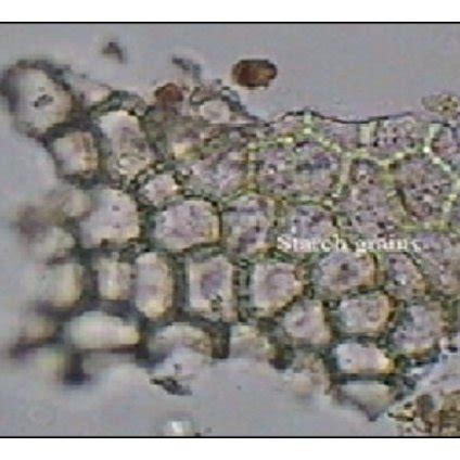 (a) Anomocytic stomata with guard cell. (b) Rosette calcium oxalate ...