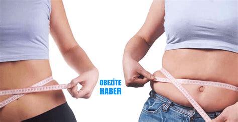 Obezite Cerrahisi İle İlgili Merak Edilen Her şey Obezite Haber