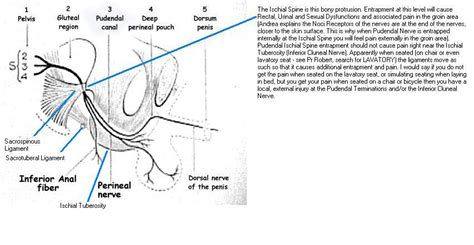 Nerve Pain: Inferior Cluneal Nerve Pain