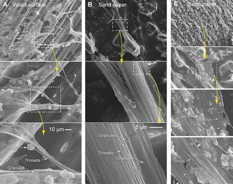 Figures And Data In Epidermal Threads Reveal The Origin Of Hagfish