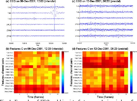 Figure 1 From Comparing SVM And Convolutional Networks For Epileptic