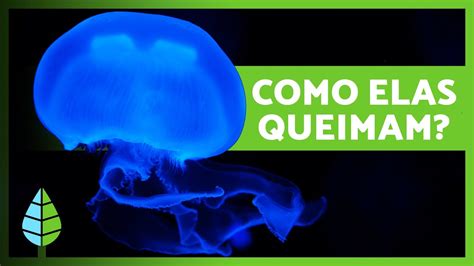 Como as ÁGUAS VIVAS QUEIMAM Como tratar uma QUEIMADURA de ÁGUA