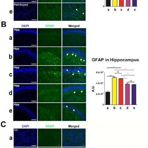 Glial Fibrillary Acidic Protein Gfap Green With Dapi Blue