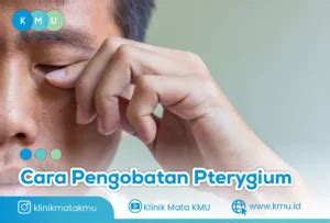 Penyakit Pterygium Gejala Penyebab Cara Mengobati