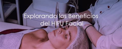 Qu Es El Hifu Facial Y Cu Les Son Sus Ventajas