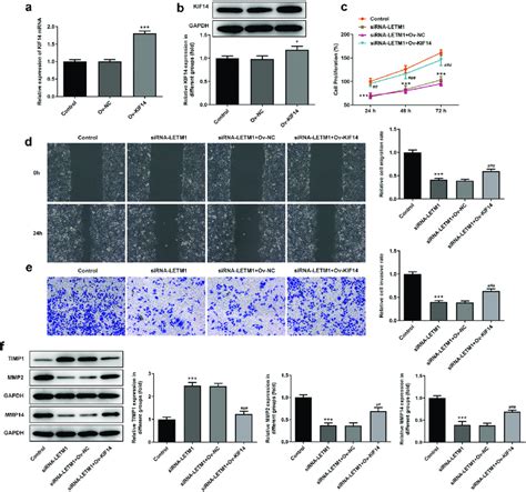 The Results Of Cell Proliferation Invasion And Migration In Escc