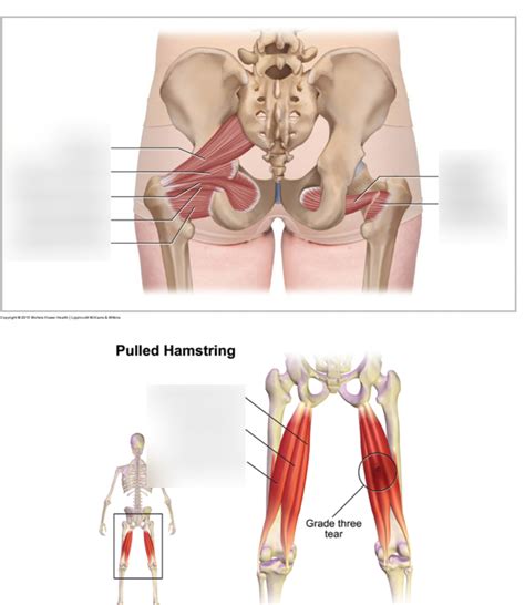 Anterior Legs Diagram Quizlet