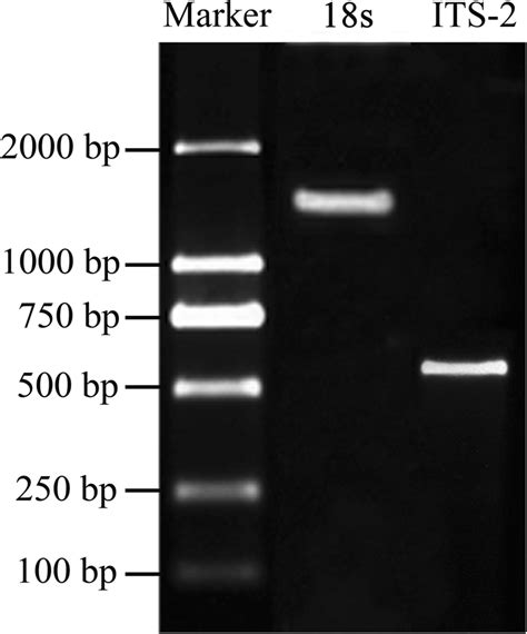 Specific Pcr Amplification Of 18s Rrna And Its 2 Genes Of Raillietina