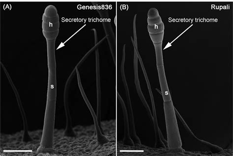 Sem Micrographs Of Secretory Trichomes With Stalk Labelled S And