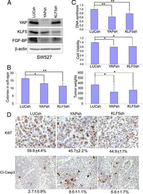 Tumorigenesis And Neoplastic Progression Yap Promotes Breast Cell