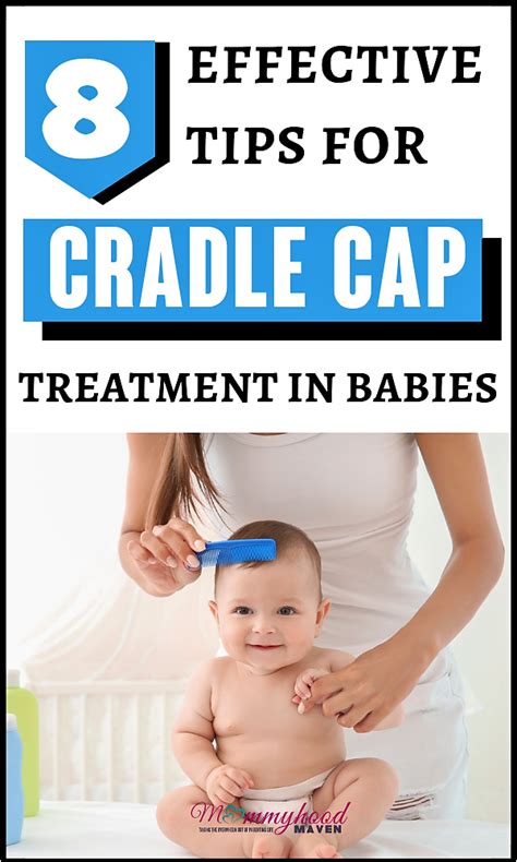 How To Treat Stubborn Cradle Cap In Babies Mommyhood Maven Cradle