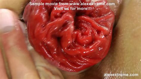 Extreme Anal Porn XNXX