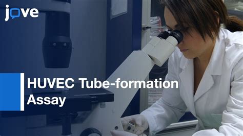 HUVEC Tube Formation Assay In Angiogenesis Protocol Preview YouTube