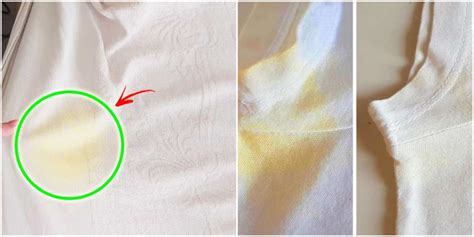 Manchas De Suor Aprenda A Eliminar O Amarelo Encardido Das Roupas