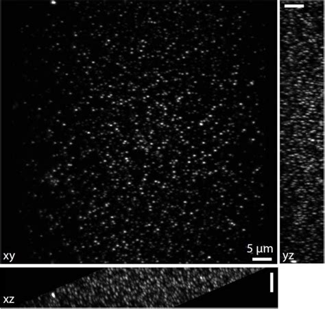 Epi Illumination Spim For Volumetric Imaging With High Spatial Temporal