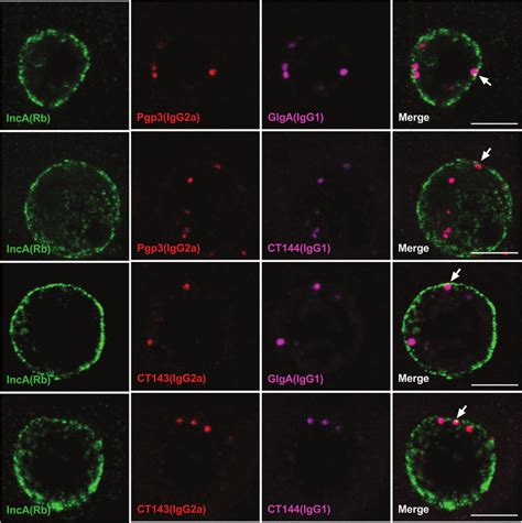 Pgp Glga Ct And Ct Colocalize To The Same Globular Structure