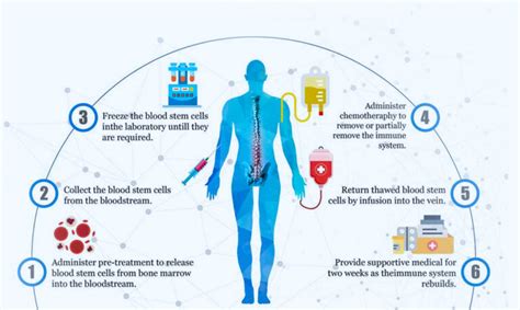 Bone Marrow Transplant Procedure