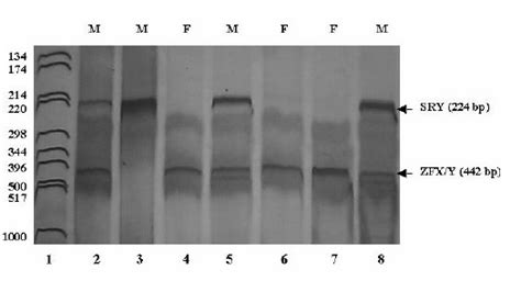 A Representative Polyacrylamide Gel Showing Gender Amplification Of Sex Download Scientific