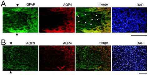 Immunohistochemistry For Aqp4 Aqp9 And Gfap At The Crushed Site On