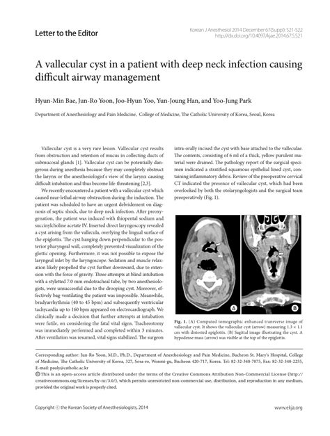 (PDF) A vallecular cyst in a patient with deep neck infection causing ...