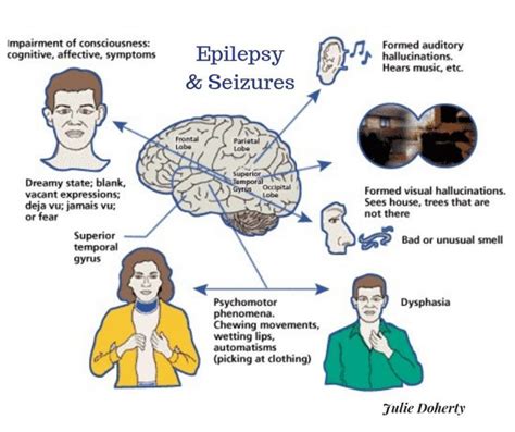 Pin on Epilepsy