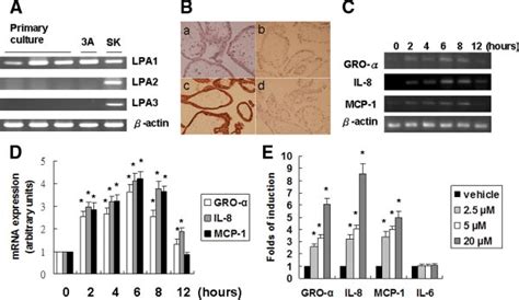 Expression Of Lpa Receptors In Human First Trimester Trophoblast Cells