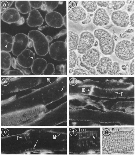 Immunofluorescence Localization Of Vinculin In Bovine Atrial Muscle