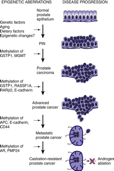 Molecular Basis Of Prostate Cancer Oncohema Key