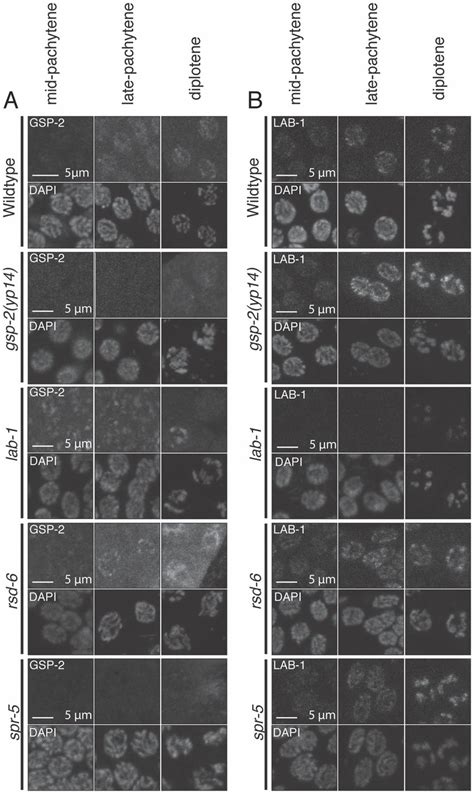 Gsp And Lab Localization During Mid Pachytene To Late Diplotene