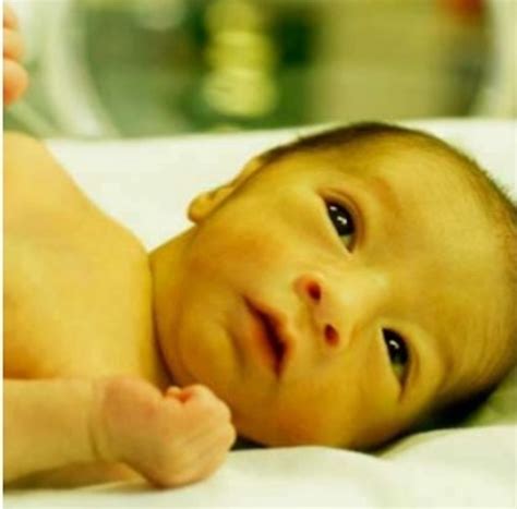 Ложная Желтуха Фото – Telegraph