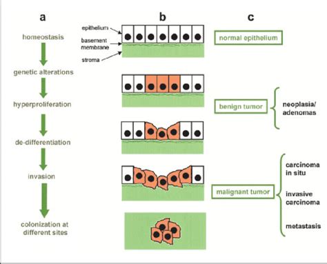 Progression From Normal Epithelia To Benign And Malignant Tumors