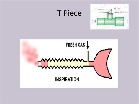 PPT - Weaning from mechanical ventilation in 21 st century PowerPoint Presentation - ID:2045894