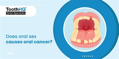 Does Oral Sex Causes Oral Cancer ToothHQ Dental Specialist