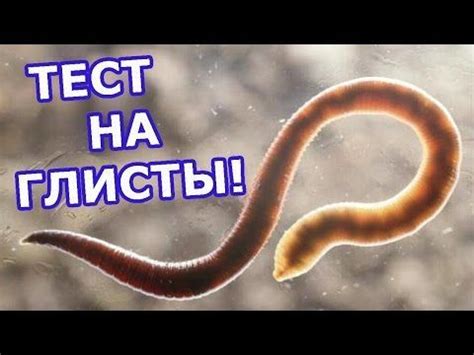 ТЕСТ НА НАЛИЧИЕ ГЛИСТОВ! ПРОВЕРЬСЯ! В этом тесте можно провериться на ...
