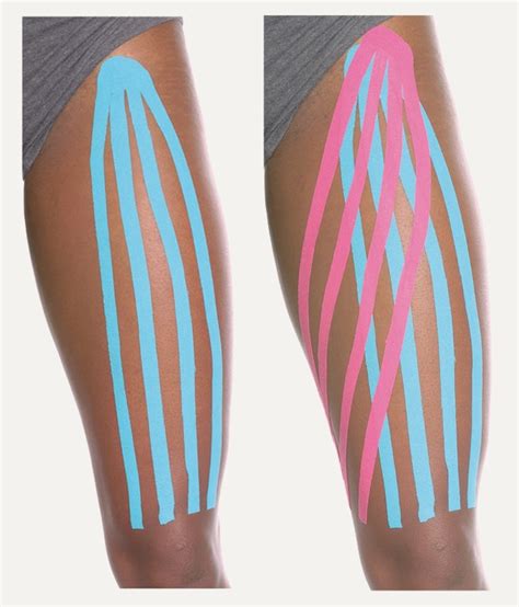 Kinesio Taping Of Superficial Lower Extremity Lymphatic Pathways Kinesio Tape