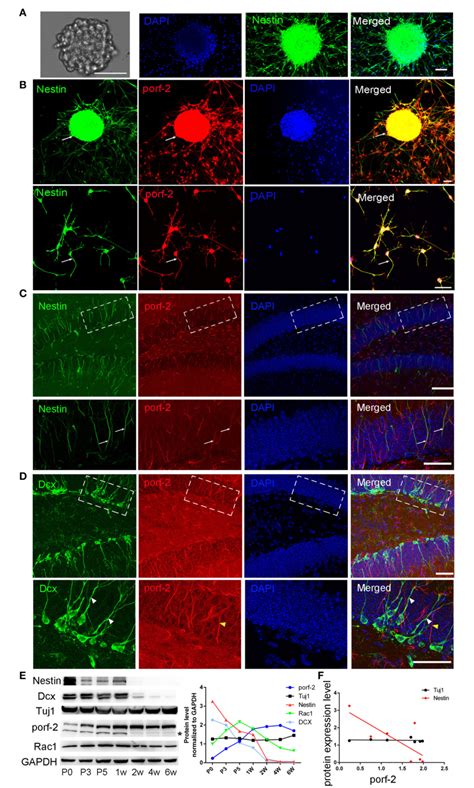 Porf 2 Inhibits Neural Stem Cell Proliferation Through Wnt β Catenin